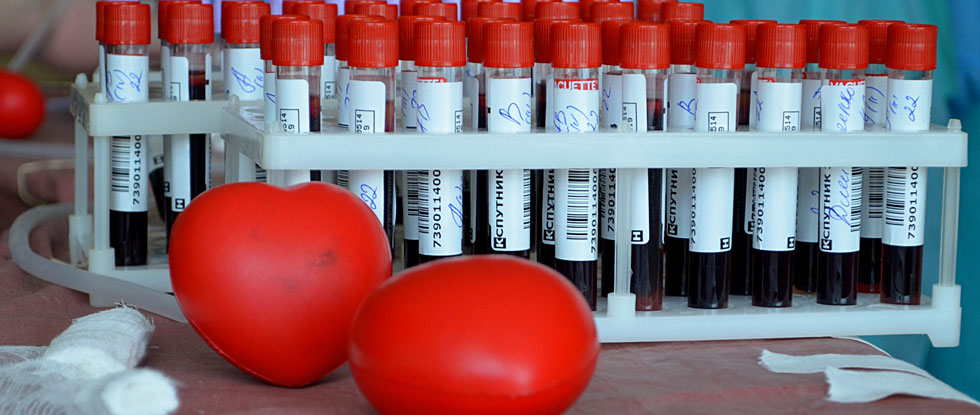 Кипр лидирует по числу доноров крови среди стран ЕС