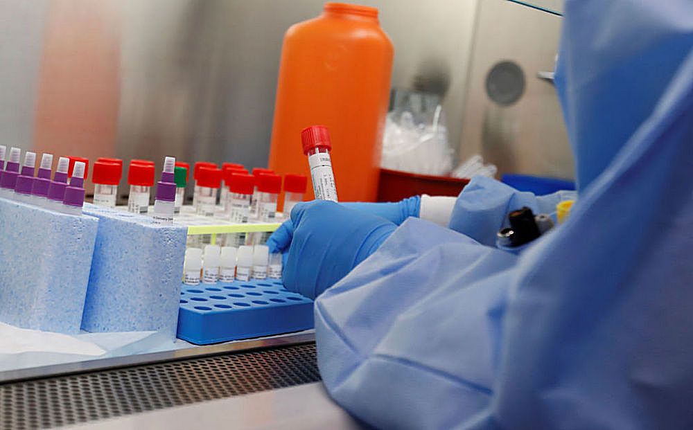 Лаборатории, которые проводят тесты на коронавирус - Вестник Кипра