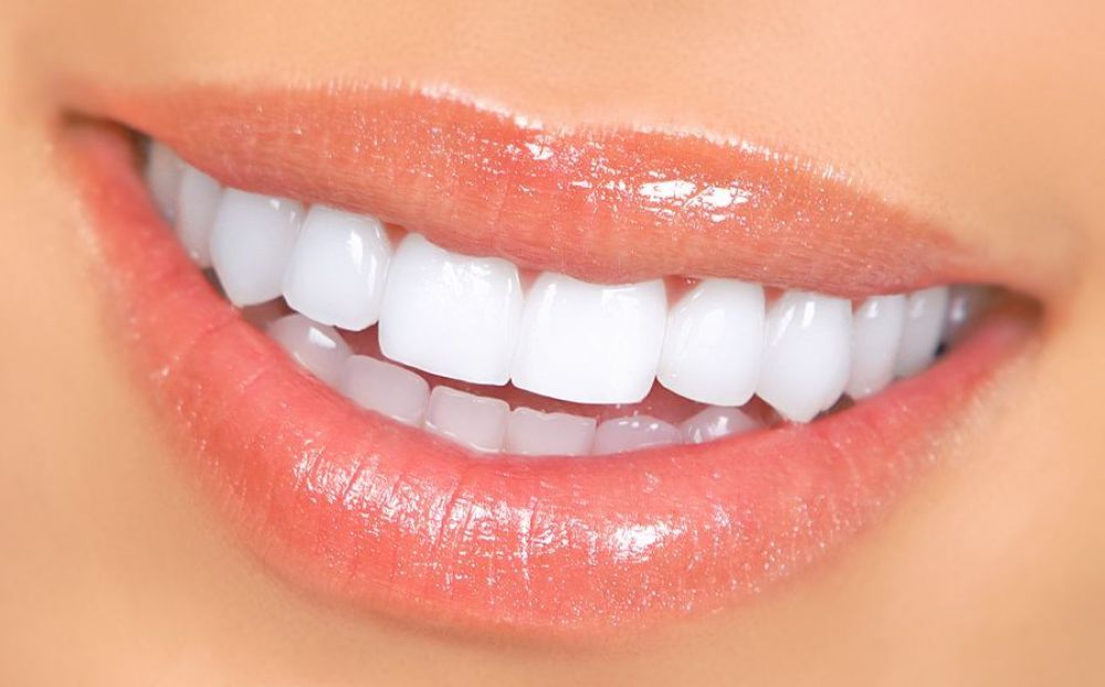 Всё, что нужно знать об отбеливании зубов - Вестник Кипра