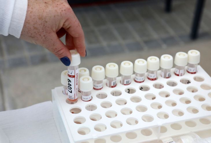 4 июля в Республике Кипр выявлены 577 новых инфицированных Covid-19