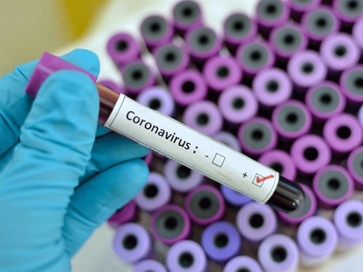 Коронавирус: 26 новых случаев за неделю